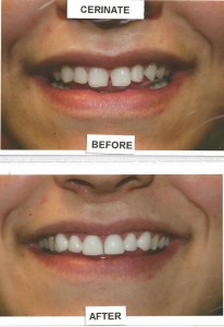 before-after-1