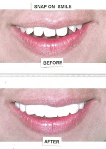 before-after-5