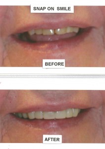 before-after-6