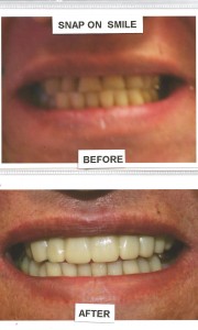 before-after-7